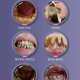 A mostrar a imagem para Um aparelho de limpeza dental + cinco tubos de pasta de dentes (para amarelamento severo dos dentes). ImagemUm aparelho de limpeza dental + cinco tubos de pasta de dentes (para amarelamento severo dos dentes).